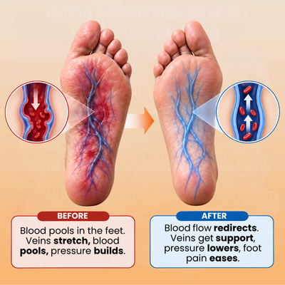 CompHeat™ Foot Pain Sleeve